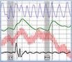 ventura polygraph examinations at AffordablePolygraph.com